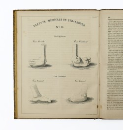 Gazette médicale de Strasbourg. Première année complète 1841.