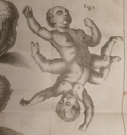 Journal de Médecine, Chirurgie, Pharmacie, &c. 2 vol. 1763 année complète.