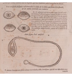 Les œuvres d'Ambroise Paré : conseiller et premier chirurgien du Roy.