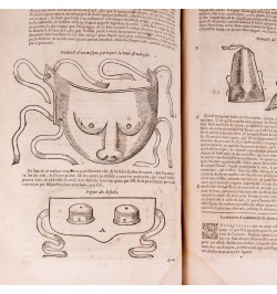 Les œuvres d'Ambroise Paré : conseiller et premier chirurgien du Roy.