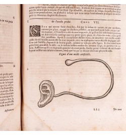 Les œuvres d'Ambroise Paré : conseiller et premier chirurgien du Roy.