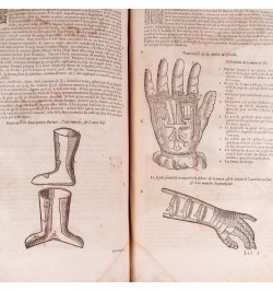 Les œuvres d'Ambroise Paré : conseiller et premier chirurgien du Roy.