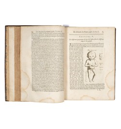 Œuvre de Mauriceau.