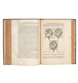 Œuvre de Mauriceau.